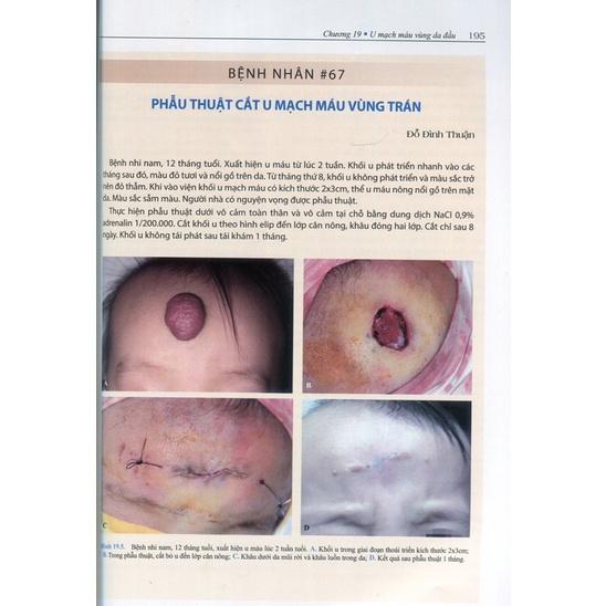 Sách - Phẫu thuật tạo hình thẩm mỹ da đầu