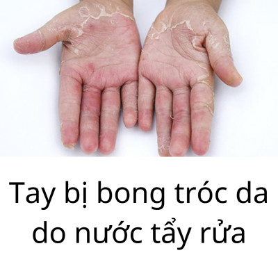 Mua 3 Tặng 2 Đôi Găng Tay cao Su Tự Nhiên Hàn Quốc Có Móc 37cm