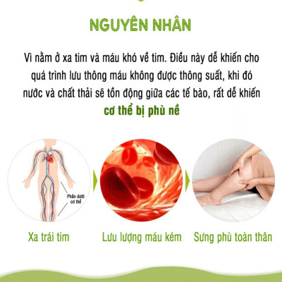 Viên uống làm thon và dài chân DHC Melilot Nhật Bản thực phẩm chức năng hỗ trợ lưu thông máu, bài tiết nước dư thừa, giảm phù nề gói 30 ngày JN-DHC-MEL30